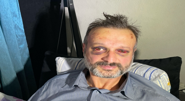 Bursa’da eğlence mekanında darbedilen piyanist yaralandı