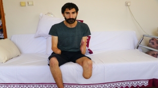 Elektrik akımına kapılıp kollarını ve bacağını kaybeden hasta kol nakli bekliyor