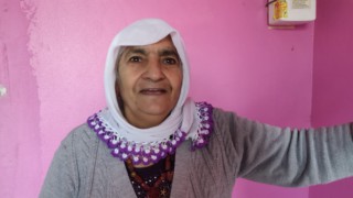 Bebekken yüzü yanan 5 yaşındaki Dilara’ya AA’nın haberiyle yardım eli uzandı